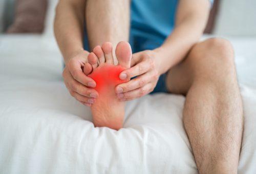 Foot,Pain,,Corns,And,Calluses,,Dry,Skin,On,Legs,,Man