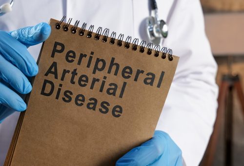 Doctor,Shows,Page,With,Peripheral,Arterial,Disease,Pad.