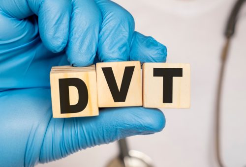 Dvt,Deep,Venous,Thrombosis,-,Word,From,Wooden,Blocks,With